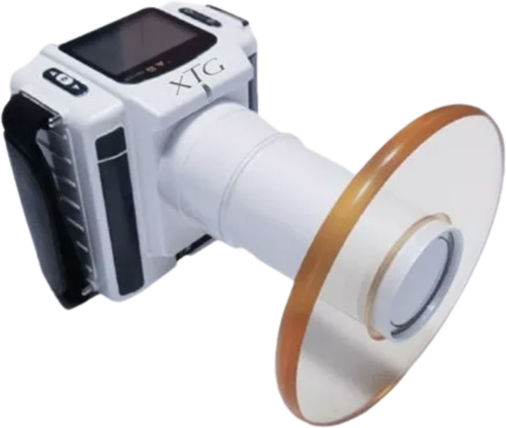 Digimed Minix S (XTG - Digital Doc) portable dental X-ray unit